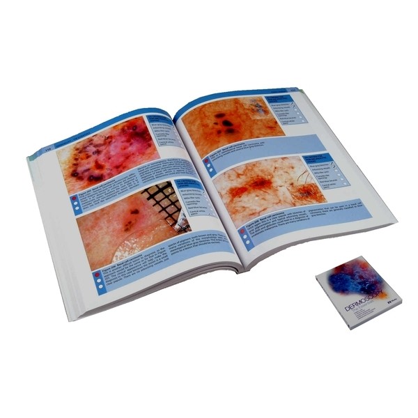 Dermoscopy - The Essentials Book (DE-L-B-100)