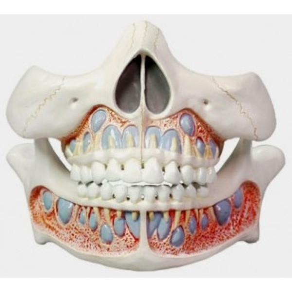 ESP Model Deciduous Teeth, Life Size (ZKH-782-D)