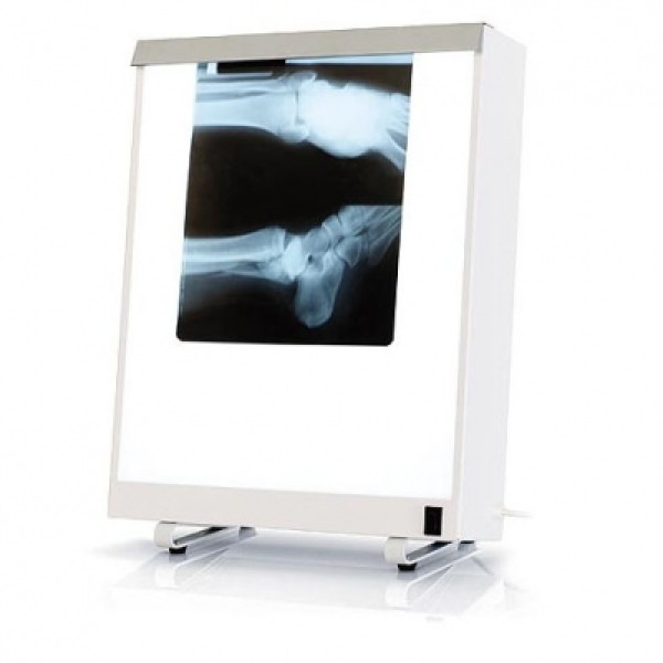 Select Desk-top Double X-ray Viewer (AWF758)