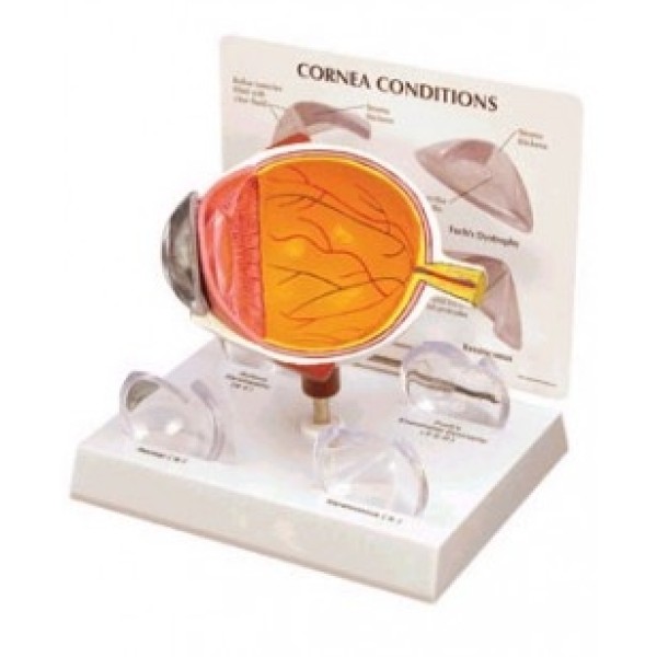 ESP Model Cornea Eye, Budget (GBM-006)