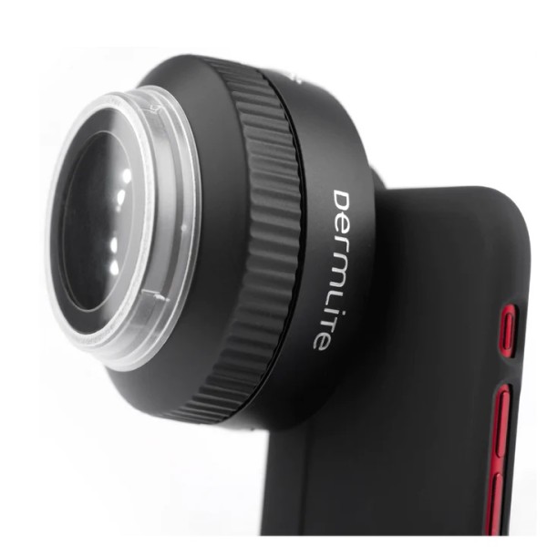 DermLite Foto X Dermoscopy Lens (DE-L-DLFX)