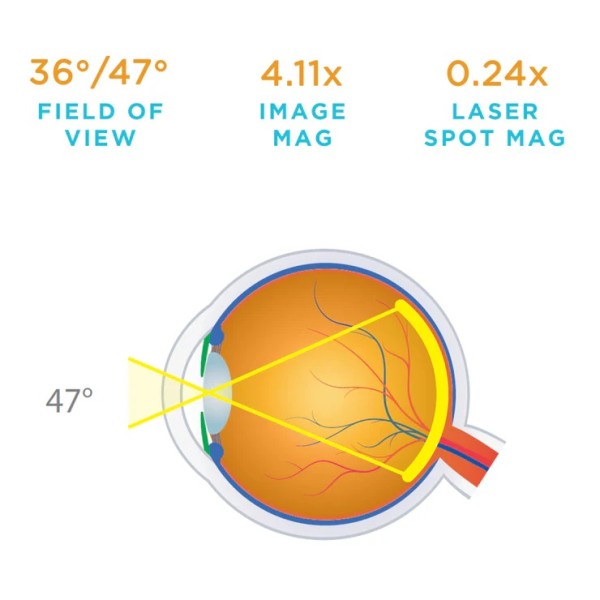 Volk 15D BIO Lens (2105-L-1218)