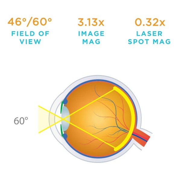 Volk 20D BIO Lens (2105-K-1159)